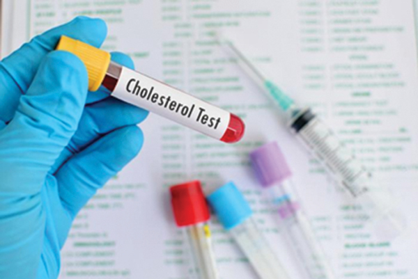 Cholesterol và những cách kiểm soát