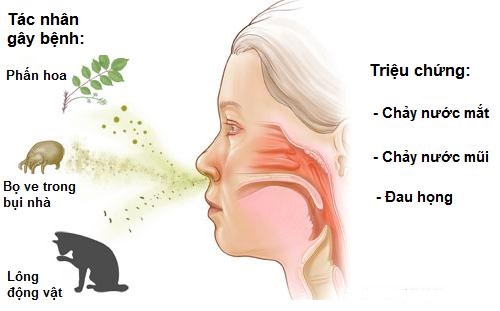 Nguyên nhân gây viêm mũi dị ứng.