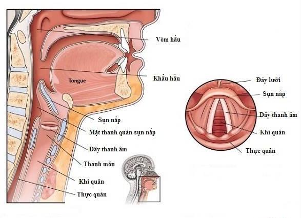 Viêm sụn nắp cấp