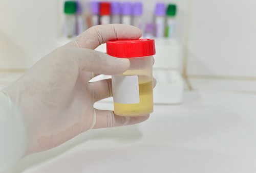 Dấu hiệu mắc bệnh về bàng quang
