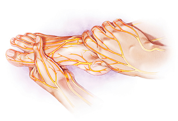 Bệnh thần kinh ngoại biên do đái tháo đường