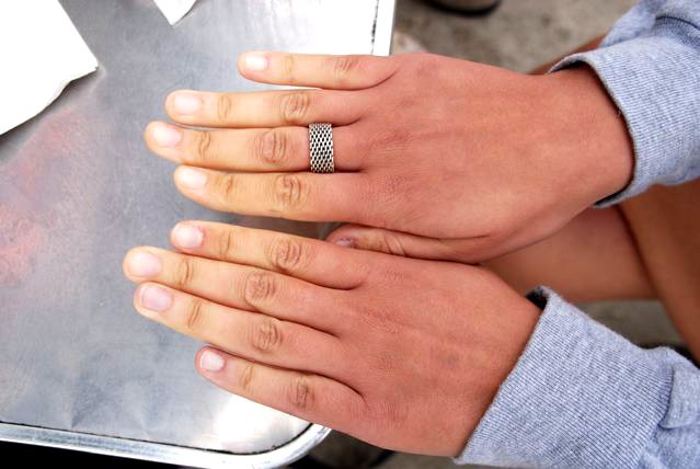 Bệnh Raynaud là vấn đề sức khỏe khiến tay chân của người bệnh bị lạnh, đổi màu (như màu đỏ hoặc màu xanh), tê liệt và thậm chí gây đau đớn khi tiếp xúc với nhiệt độ lạnh hoặc bị căng thẳng.