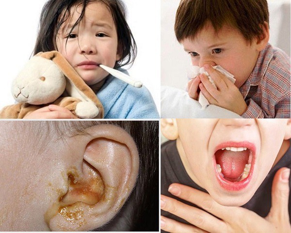 Các dấu hiệu mắc TMH.