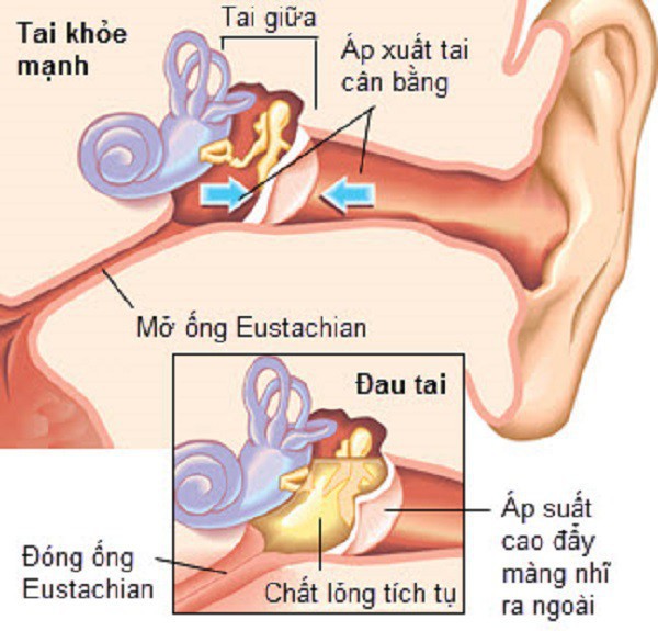 Tính đến thời điểm hiện tại đã có rất nhiều phương pháp để điều trị các bệnh lý về TMH