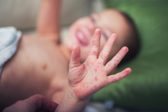 Ảnh: SignatureCare Emergency Center