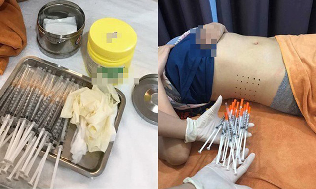 Nội dung quản cáo trên mạng internet của một số viện thẩm mỹ, spa, trung tâm giảm béo.