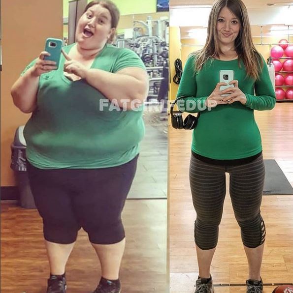 Cơ thể gây ám ảnh của cô gái giảm 141kg trong hơn 1 năm