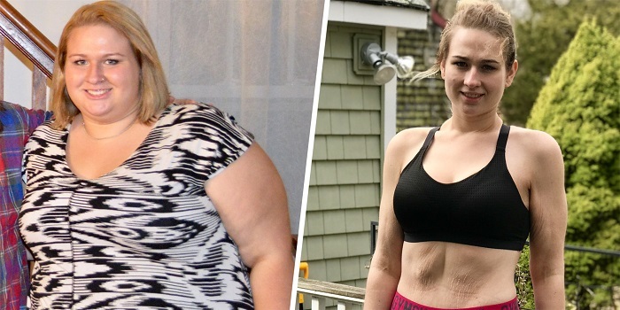Bị chê cười vì béo, cô gái giảm liền 90kg, lột xác thành hot girl nóng bỏng
