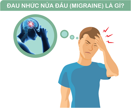 Tác hại của bệnh đau nửa đầu Migraine