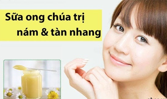 sữa ong chúa - tuyệt chiêu trị nám tàn nhang trên da