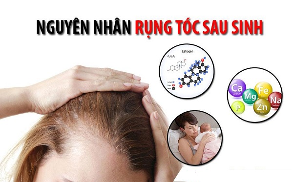 Nguyên nhân rụng tóc hàng đầu