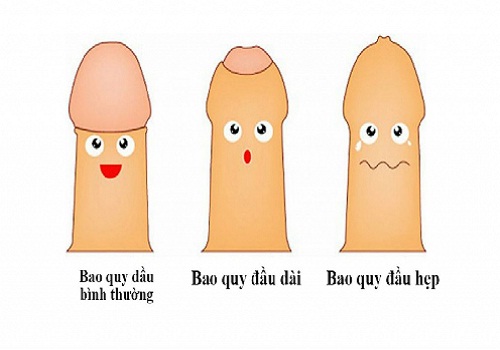 nguyen-nhan-gay-viem-duong-tiet-nieu-2
