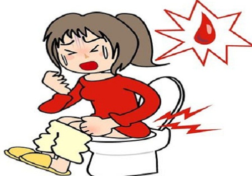 Trĩ nội là gì? có nguy hiểm không?