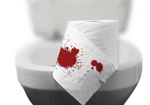 Polyp hậu môn: nguyên nhân, dấu hiệu, hình ảnh và cách chữa trị - Phòng Khám Đa Khoa An Giang