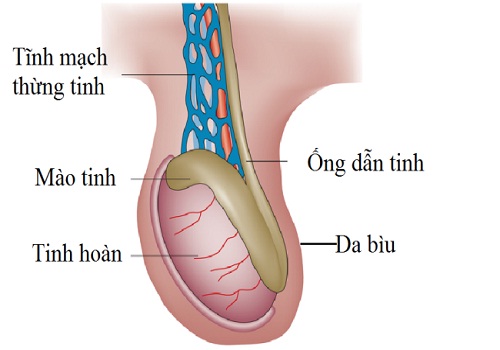 Tác hại giãn tĩnh mạch thừng tinh đối với nam giới