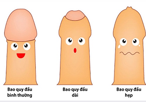 Các dấu hiệu triệu chứng viêm bao quy đầu ở nam giới