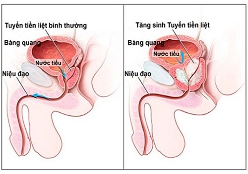 Địa chỉ khám bệnh nam khoa ở đâu? Phòng khám uy tín tại An Giang?