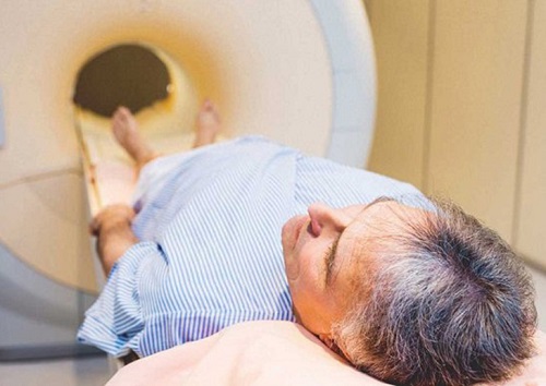Cách chữa/ điều trị ung thư tiền liệt tuyến an toàn