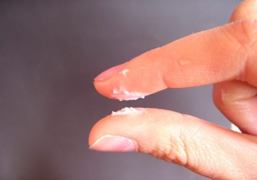 Tinh trùng vón cục có chữa được không? Chuyên gia giải đáp