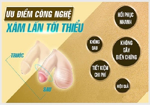 Dấu hiệu của dài bao quy đầu ở nam giới
