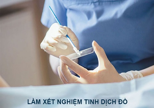 Cách kiểm tra tinh trùng mạnh hay yếu ở nam giới