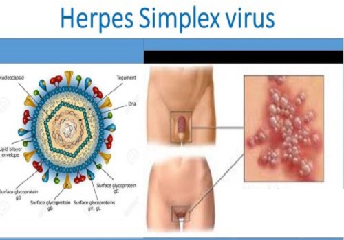 Hình ảnh mụn rộp sinh dục nam giới