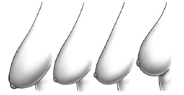 Ngực 'quả mướp' và những lầm tưởng của hầu hết mọi người - 2