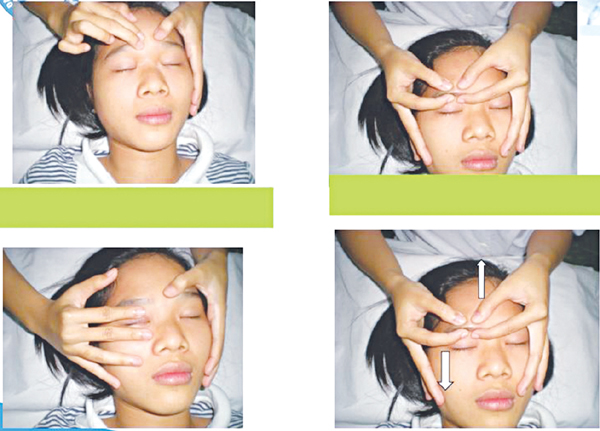 Xoa bóp - bấm huyệt điều trị liệt dây thần kinh vii ngoại biên