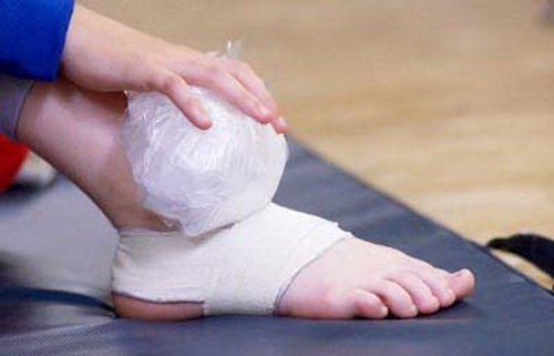 Khi bị bong gân nên chườm lạnh ngay lập tức để giảm sưng và đau.