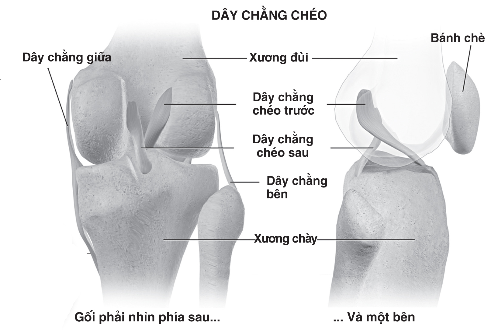 Khi dây chằng chéo trước khớp gối bị tổn thương