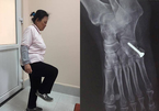 Khó tin, một phụ nữ Hà Nội uống hàng chục kg thuốc giảm đau