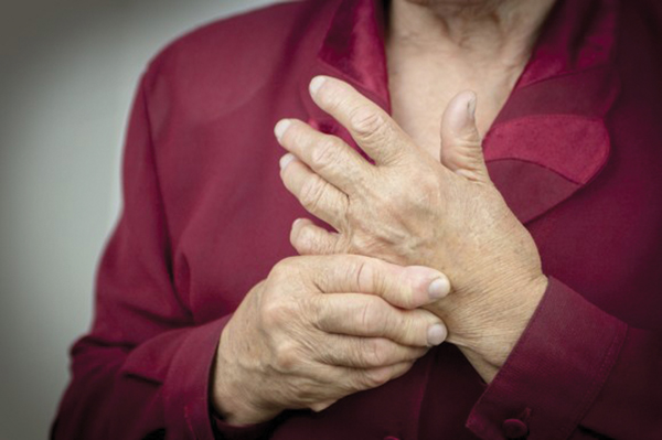 Nghệ rất tốt trong điều trị viêm khớp