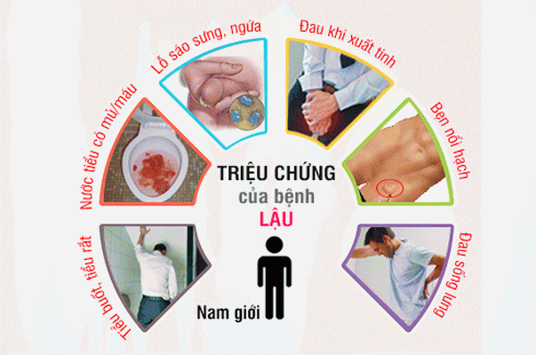 Khi có những triệu chứng của bệnh lậu, cần đi khám ngay.
