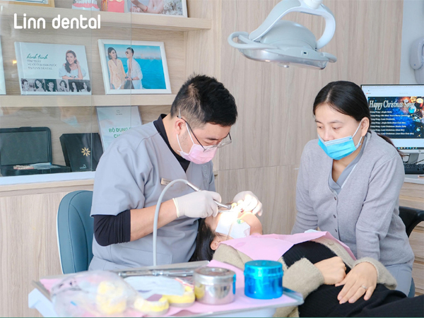 Cần chú ý gì khi dán sứ veneer?