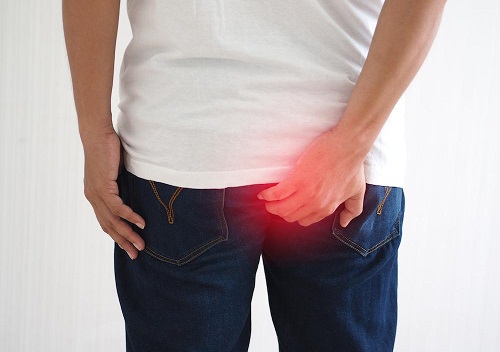Quy trình khám bệnh trĩ ngoại tại phòng khám đa khoa An Giang