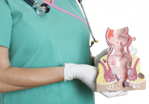 Cắt lòi con trê có đau hay không? Chuyên gia chia sẻ
