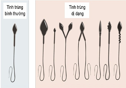 Làm thế nào để nhận biết tinh trùng yếu?