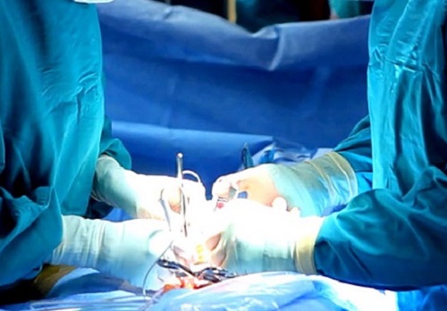 Phương pháp điều trị tinh trùng yếu an toàn hiệu quả