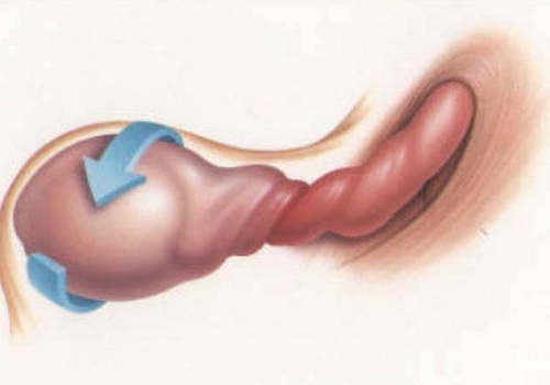 Đau tinh hoàn bên phải sau khi quan hệ nguyên nhân là gì? Có nguy hiểm không?