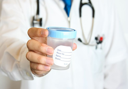 Xét nghiệm tinh trùng những điều nam giới cần biết