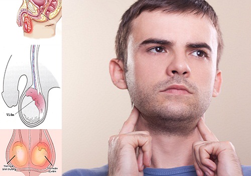 Tinh hoàn bên to bên nhỏ nguyên nhân là bệnh gì?