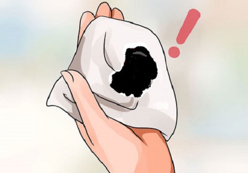 Nguyên nhân kinh nguyệt vón cục màu đen ở phụ nữ