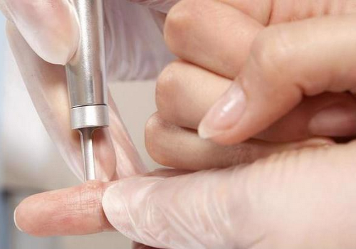 Chi phí đốt laser sùi mào gà hết bao nhiêu tiền?