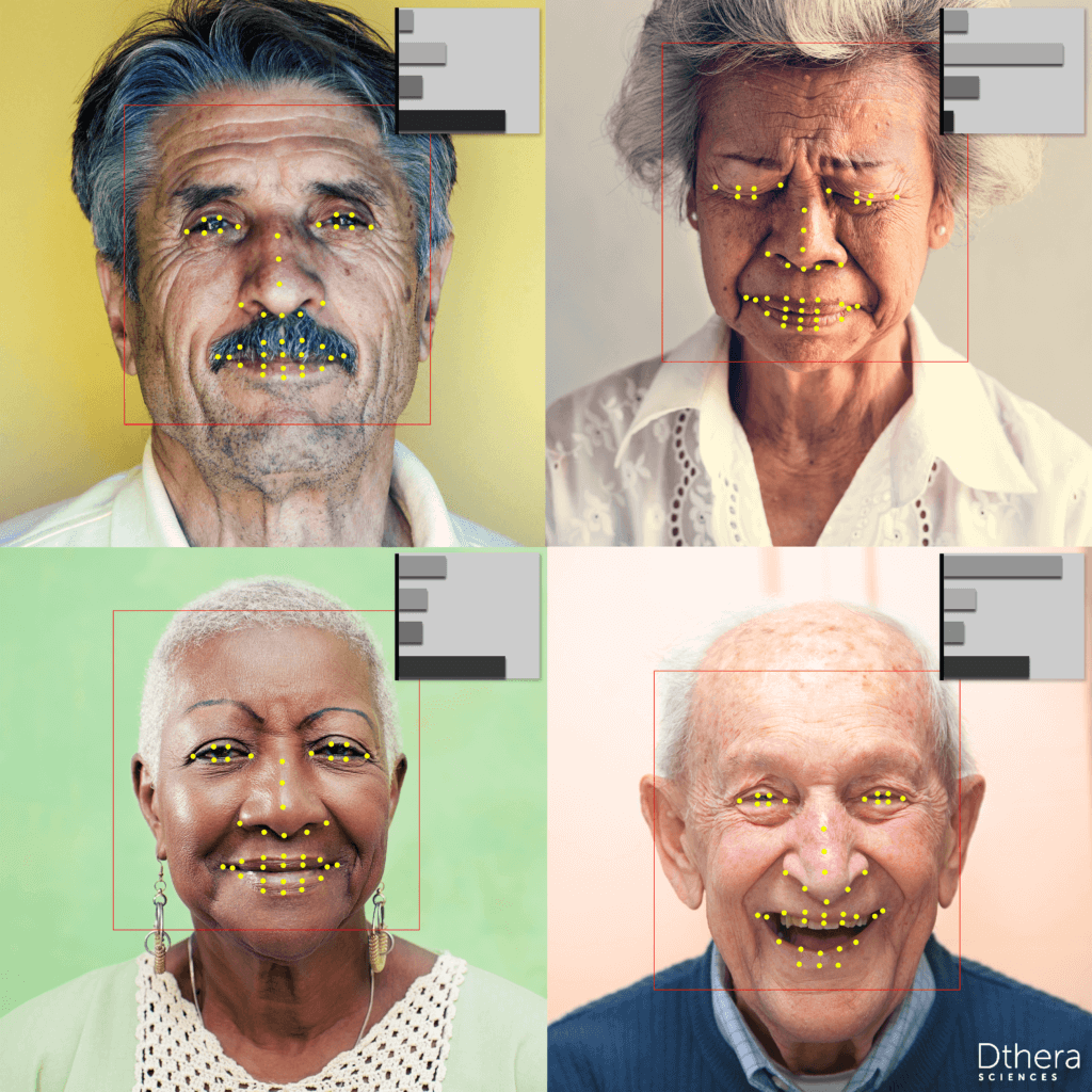 Microexpression analytics being used for Alzheimer's DTx response evaluation