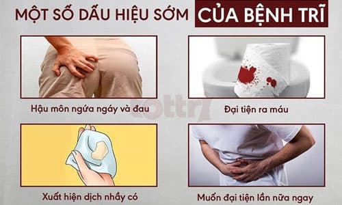 Dấu hiệu sớm của bệnh trĩ.