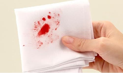 Dấu hiệu bệnh trĩ nội độ 1