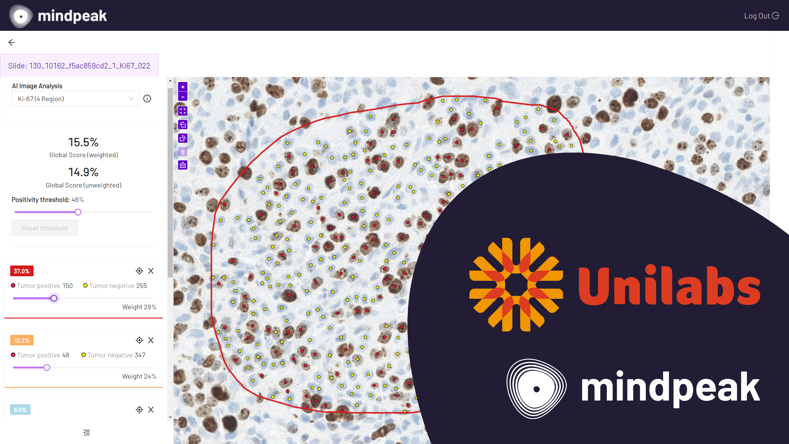 Unilabs Selected Mindpeak's AI Software