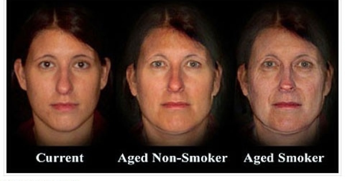 Smoking and ageing