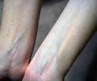 Vein test