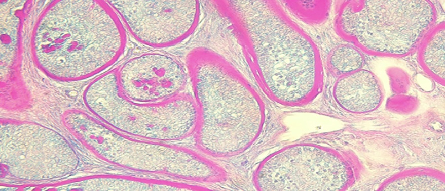 Dermatohistologie und Histographie